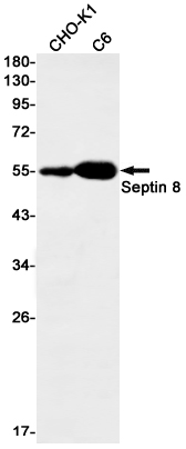 Septin 8 Rabbit mAb