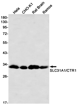 SLC31A1 Rabbit mAb