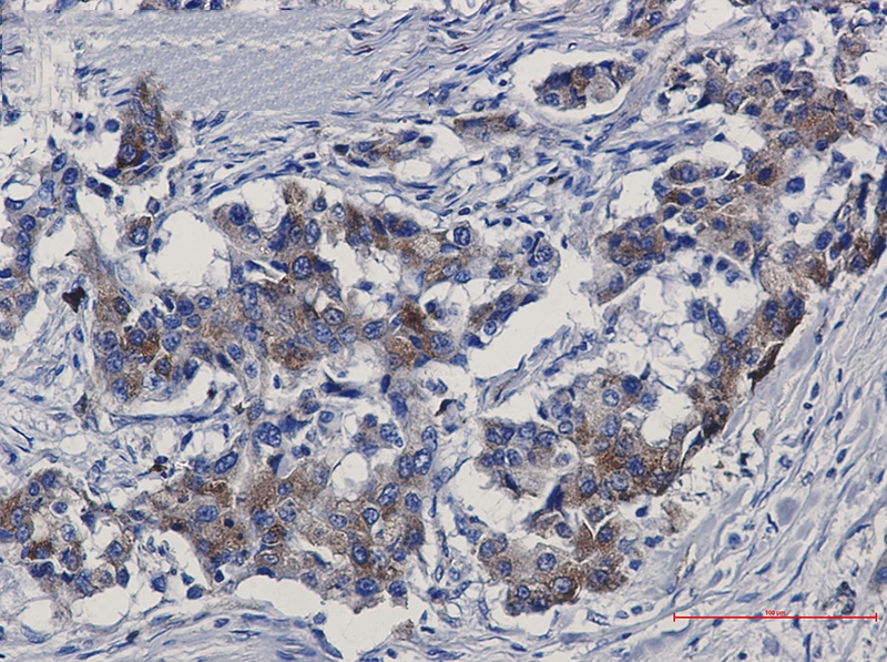 Sortilin Rabbit mAb