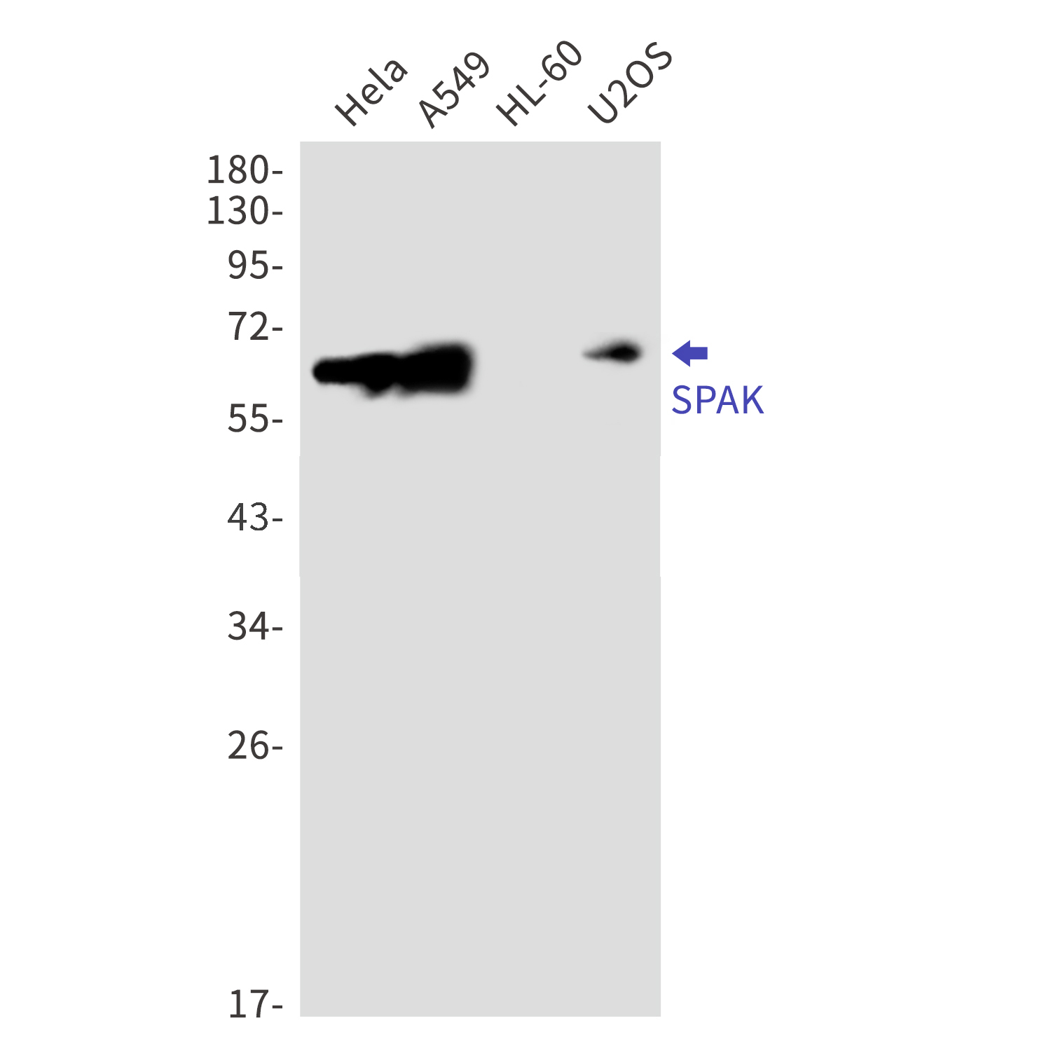 SPAK Rabbit mAb