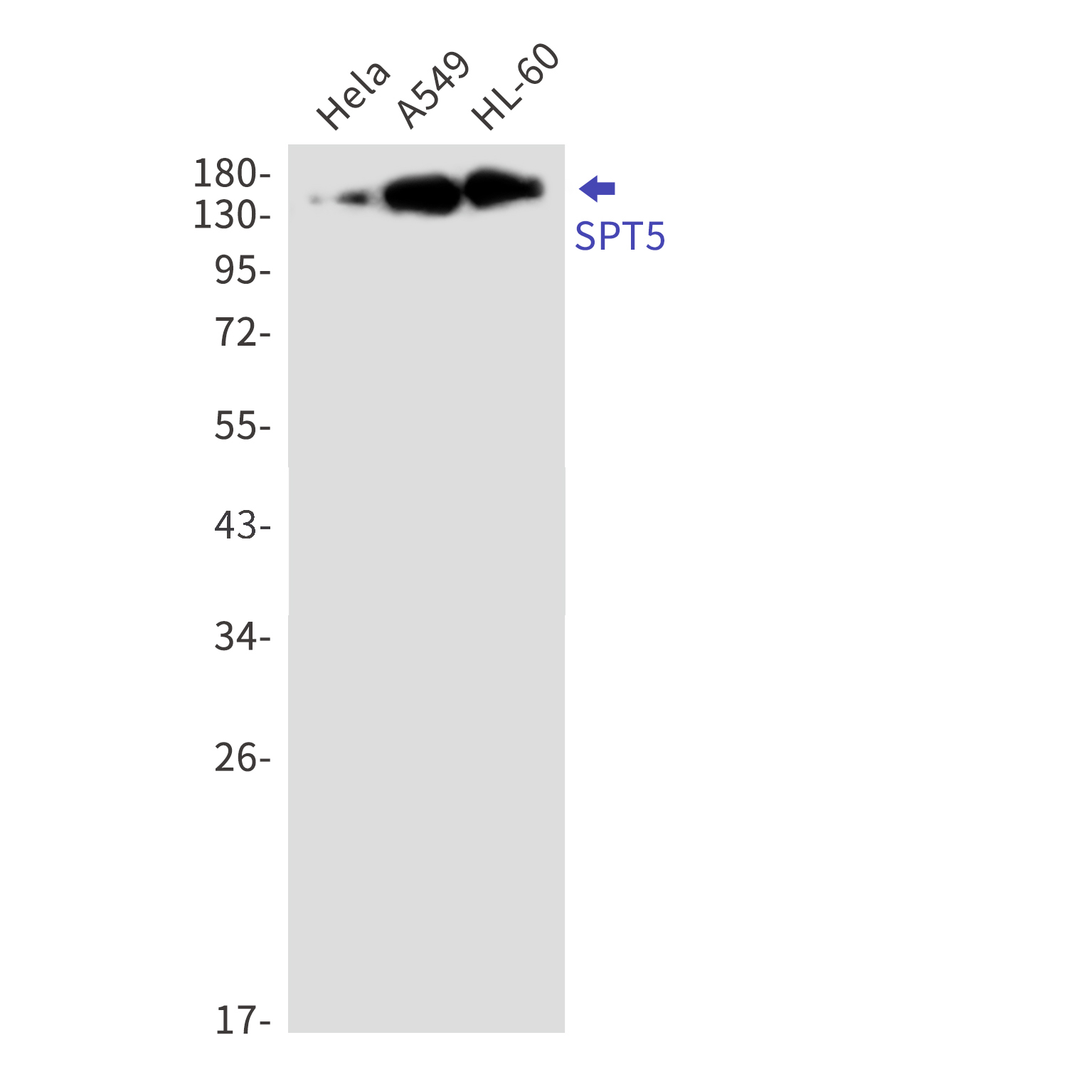 SPT5 Rabbit mAb