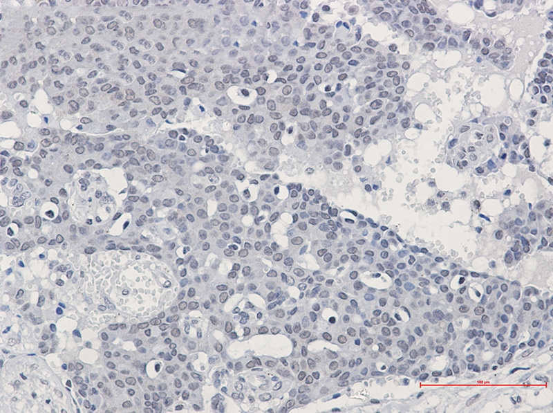 SPT5 Rabbit mAb