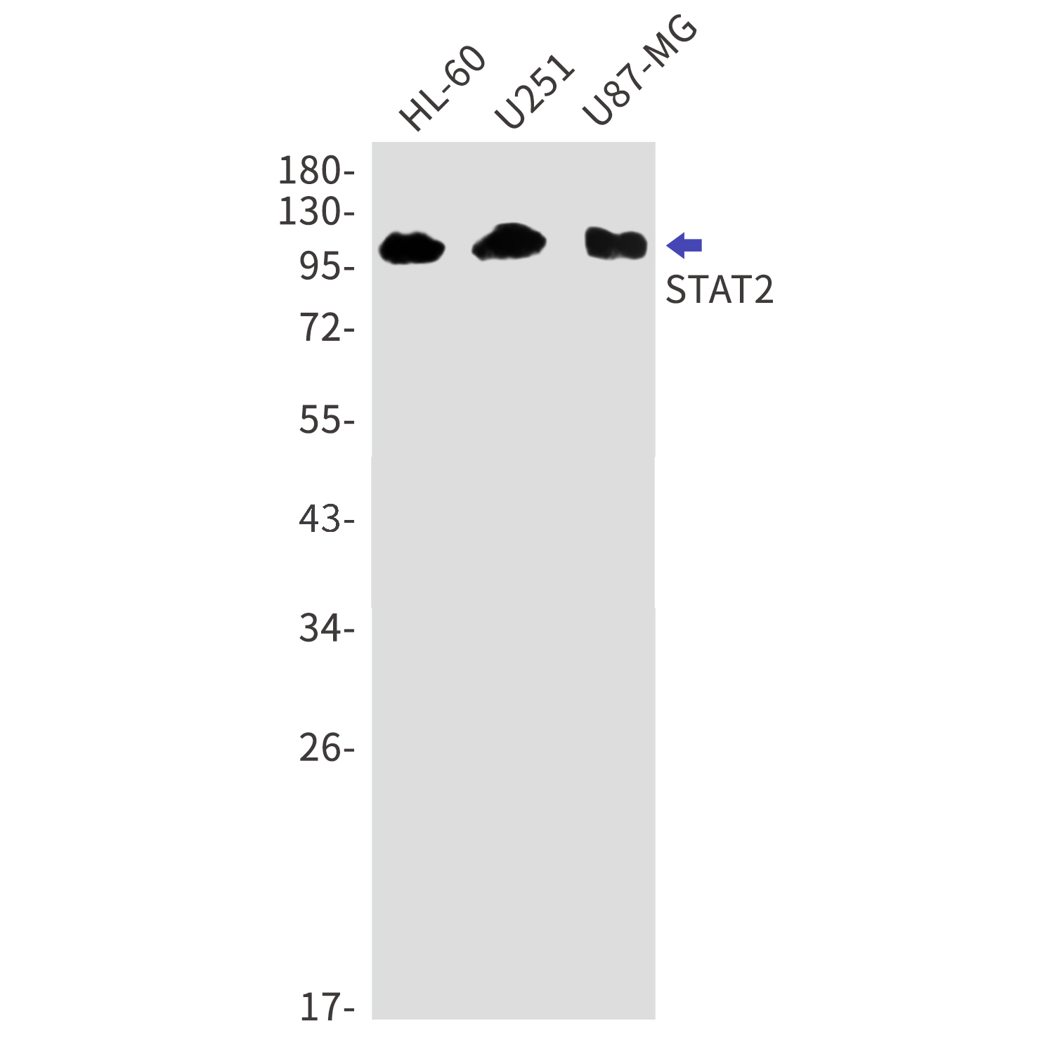 STAT2 Rabbit mAb