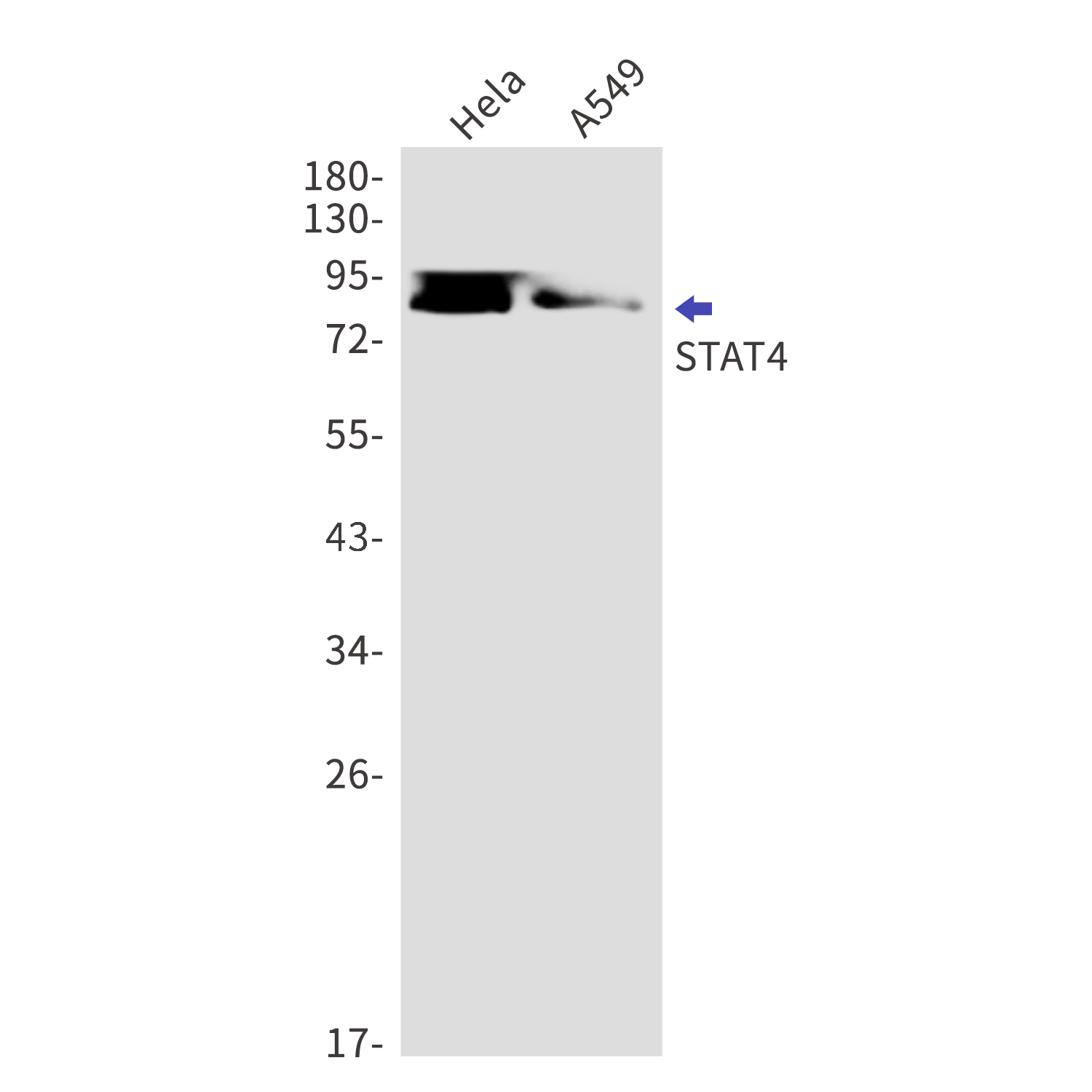 STAT4 Rabbit mAb