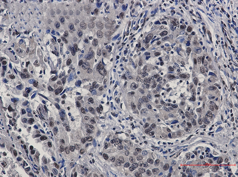 STAT4 Rabbit mAb