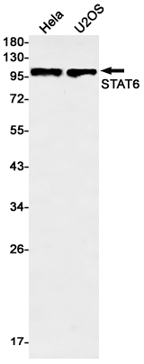 STAT6 Rabbit mAb