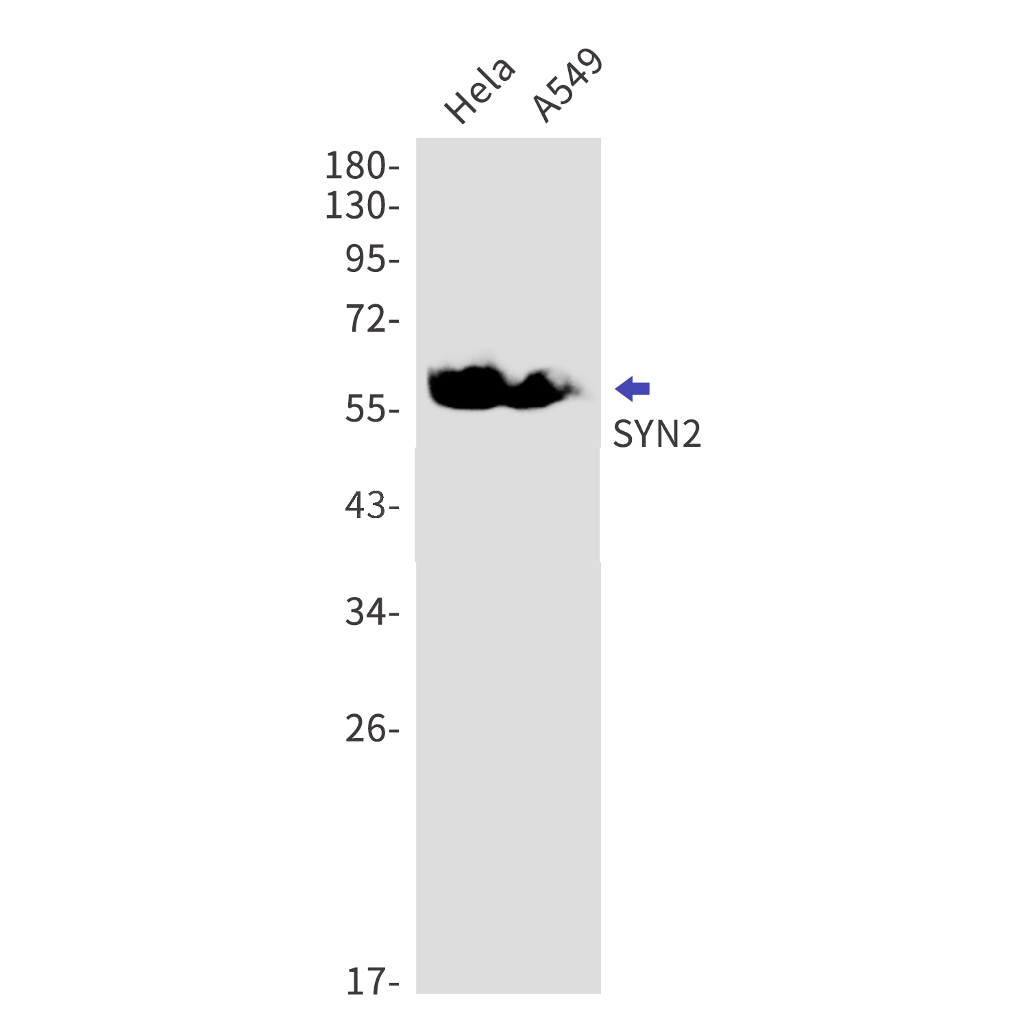 Synapsin 2 Rabbit mAb