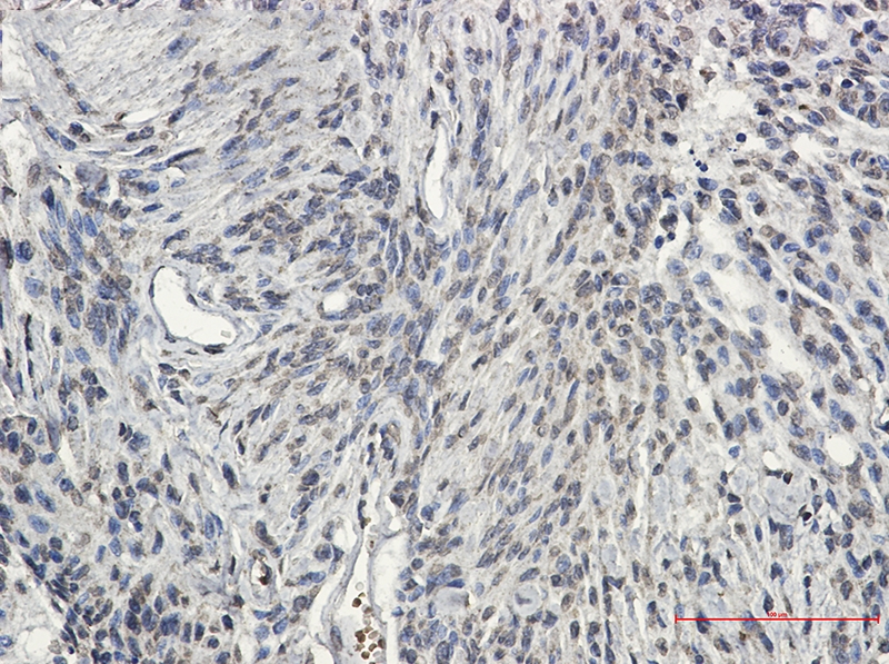 Synapsin 2 Rabbit mAb