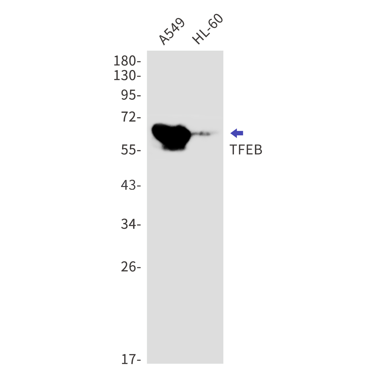 Transcription Factor EB Rabbit mAb