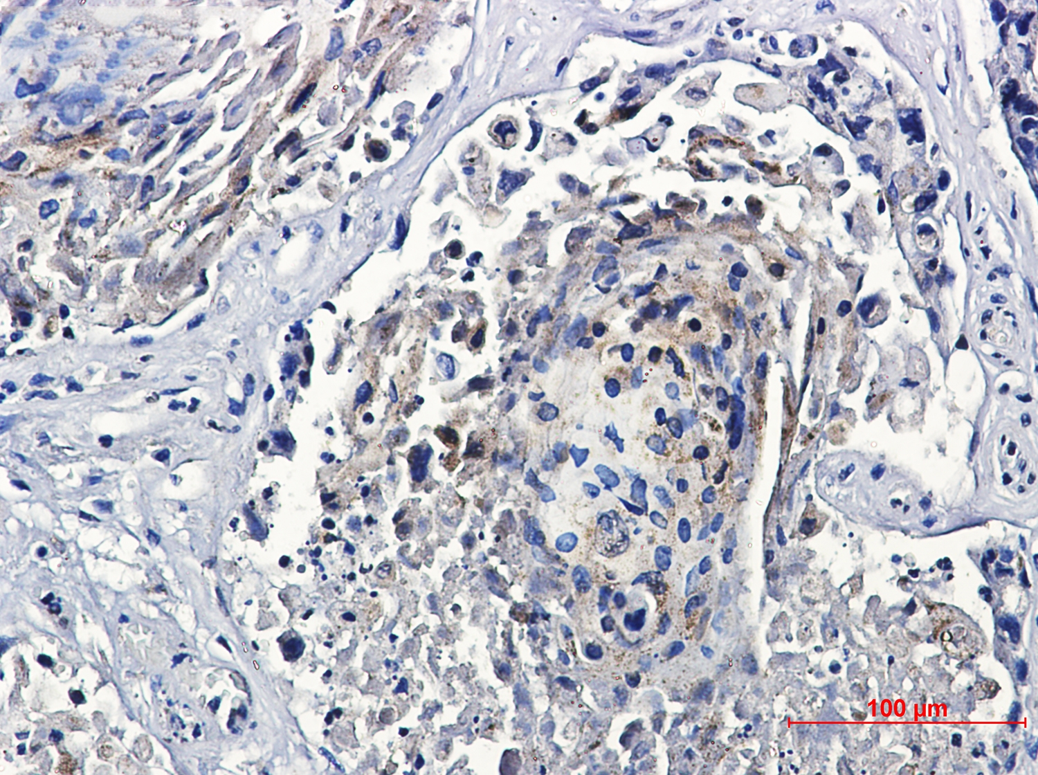 Transcription Factor EB Rabbit mAb