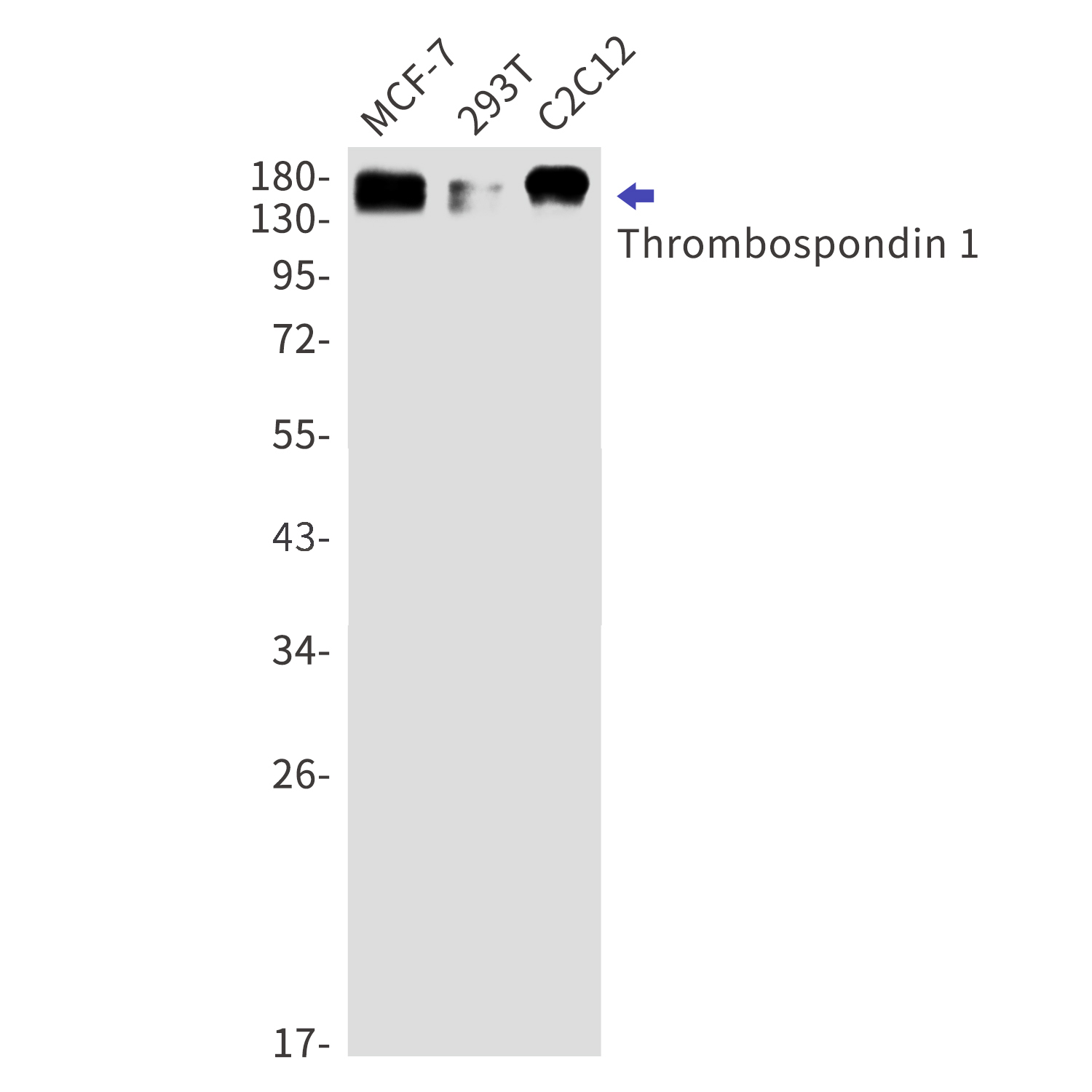 Thrombospondin 1 Rabbit mAb