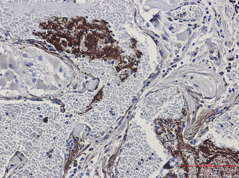 Thrombospondin 1 Rabbit mAb