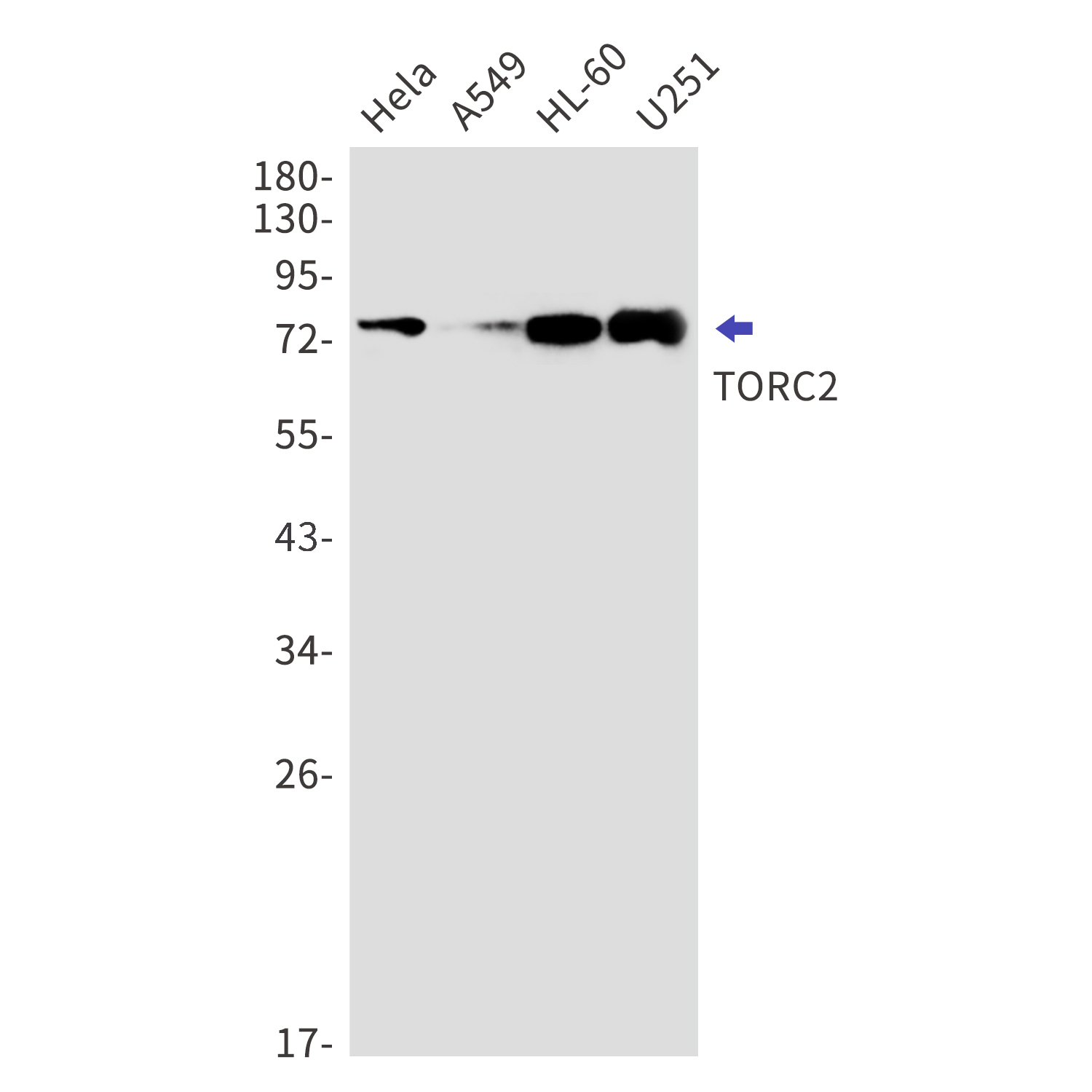 CREB Regulated Transcription Coactivator 2 Rabbit mAb