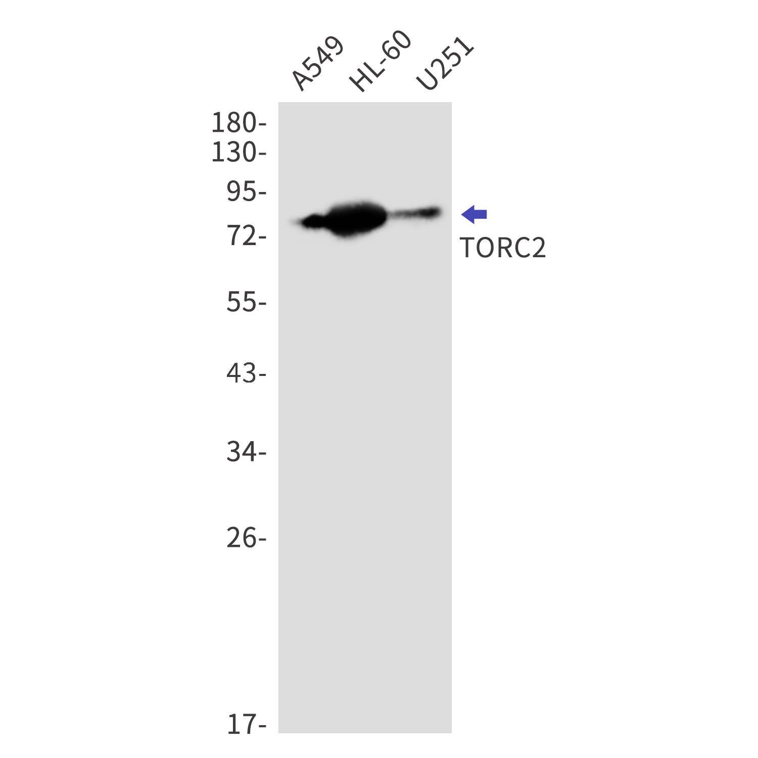 CREB Regulated Transcription Coactivator 2 Rabbit mAb