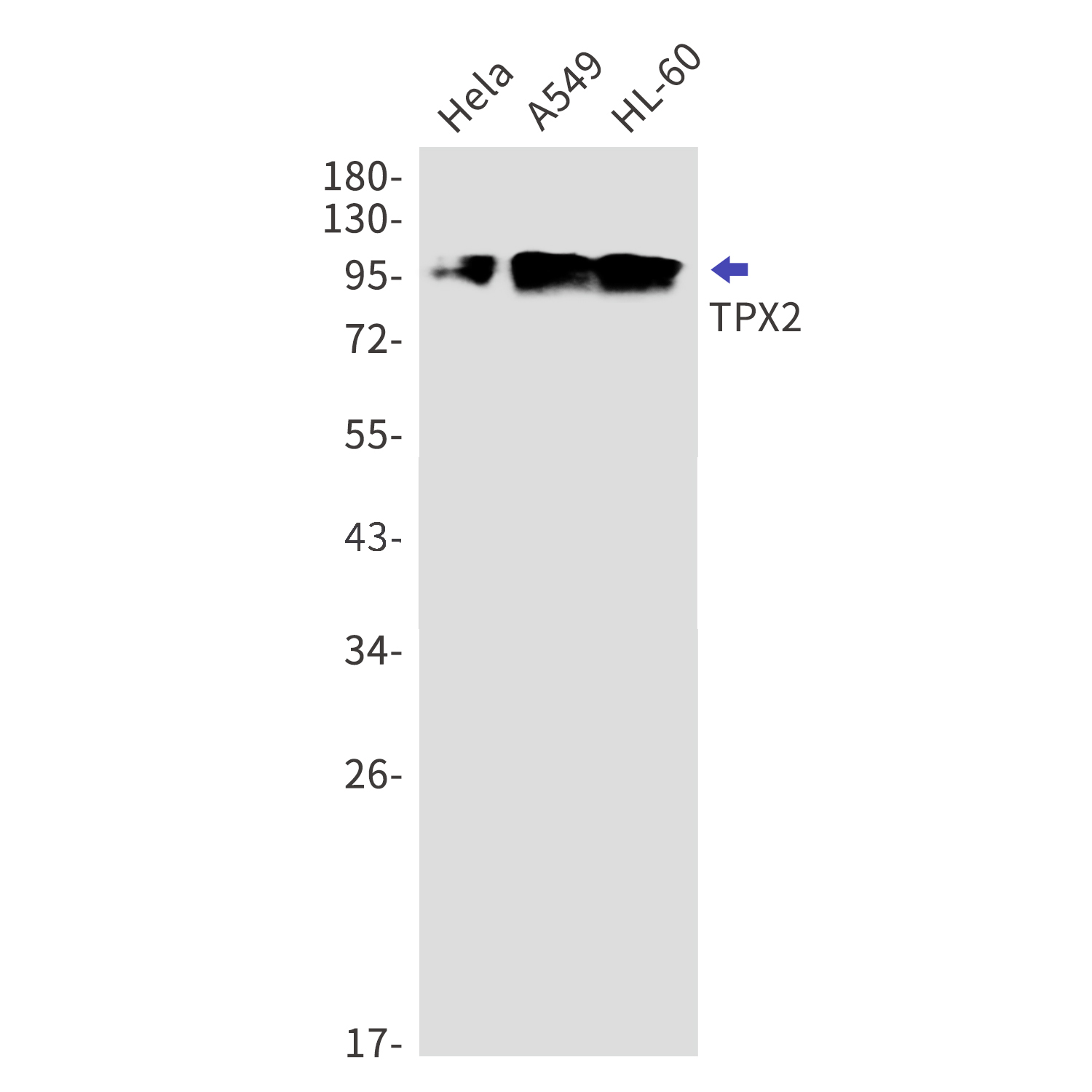 TPX2 Rabbit mAb