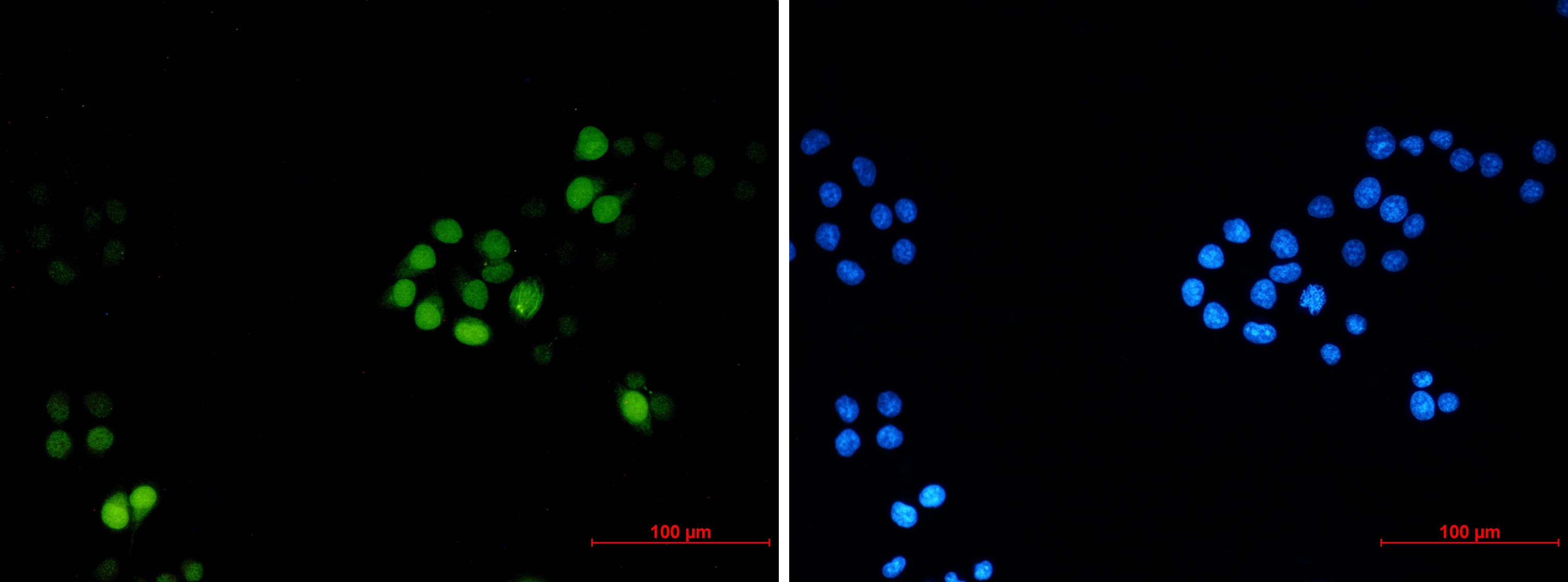 TPX2 Rabbit mAb