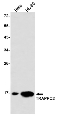 TRAPPC2 Rabbit mAb