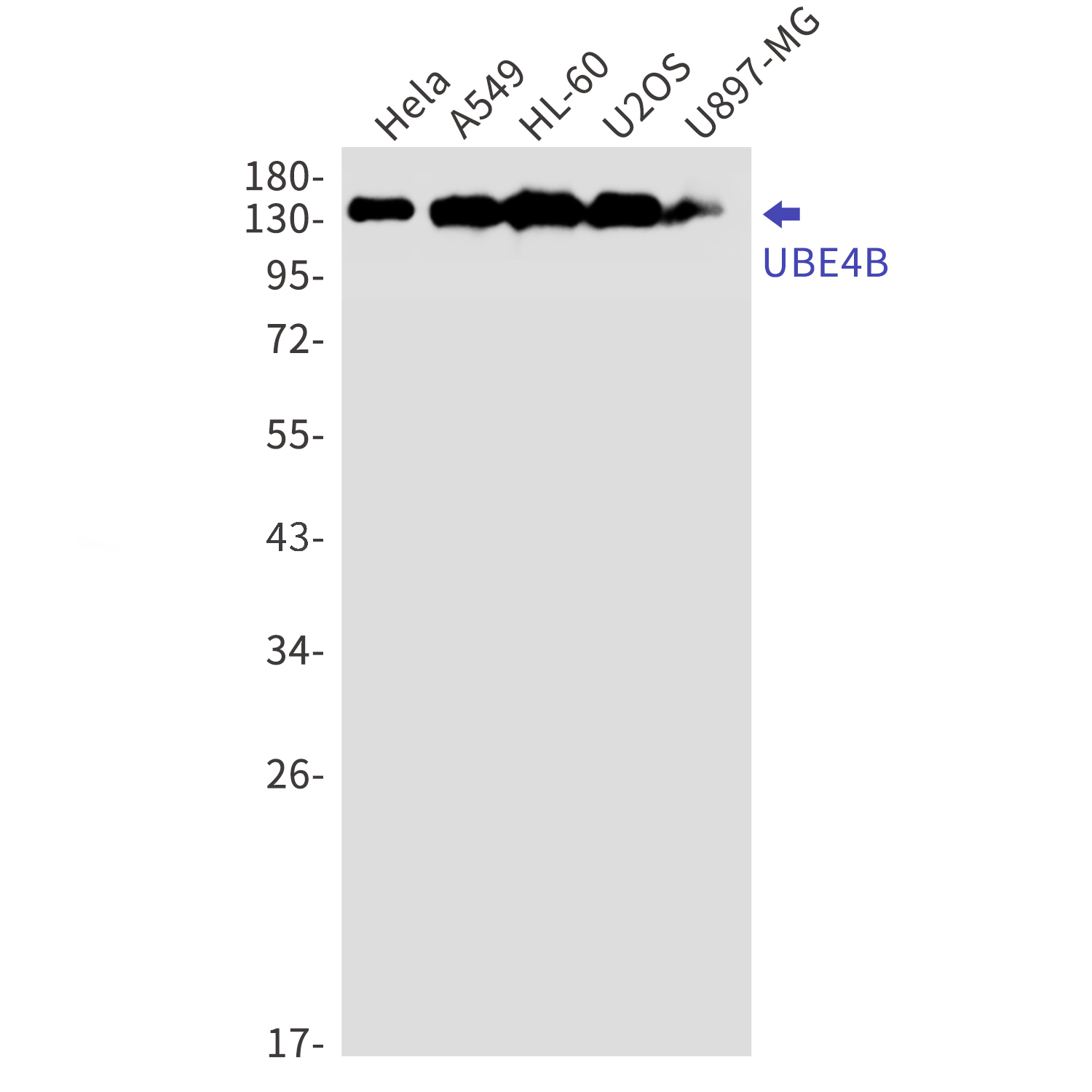 Ubiquitin Conjugation Factor E4 B Rabbit mAb