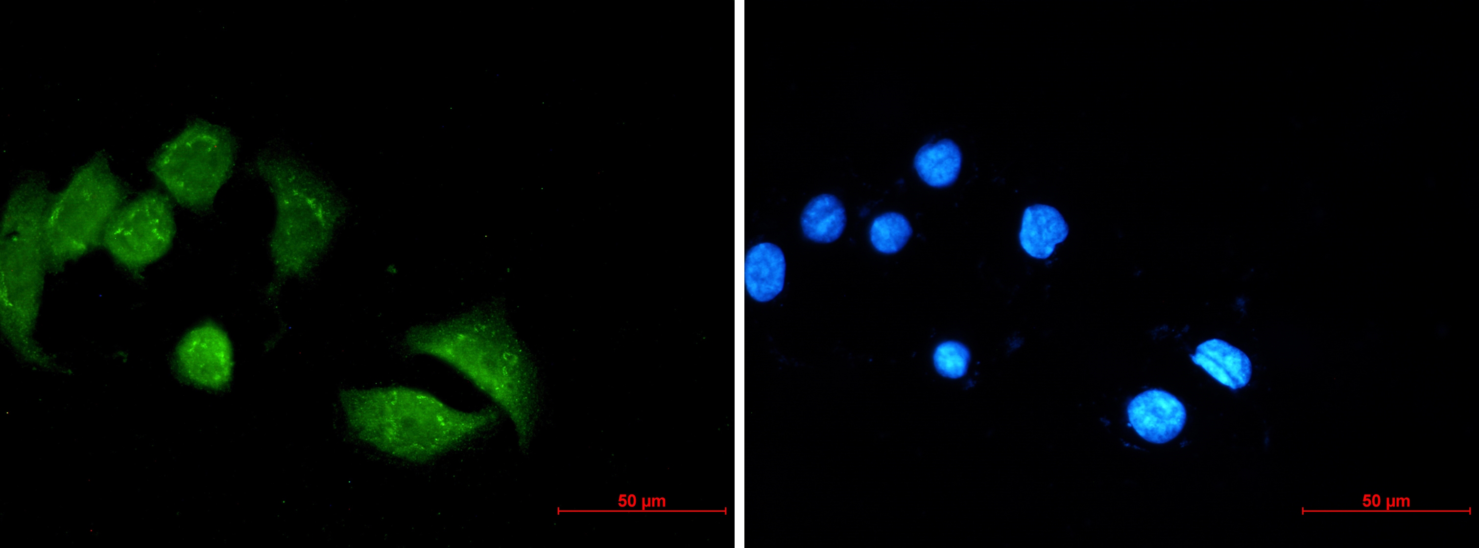 Ubiquitin Conjugation Factor E4 B Rabbit mAb