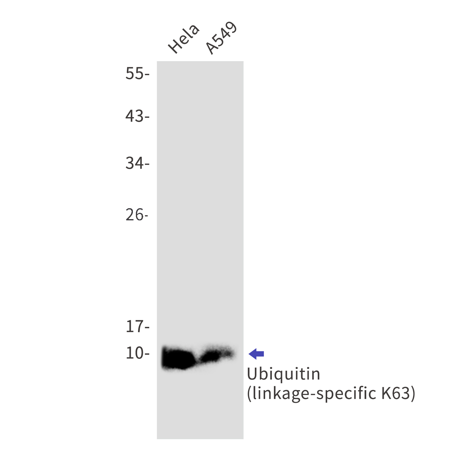 Ubiquitin K63 Rabbit mAb