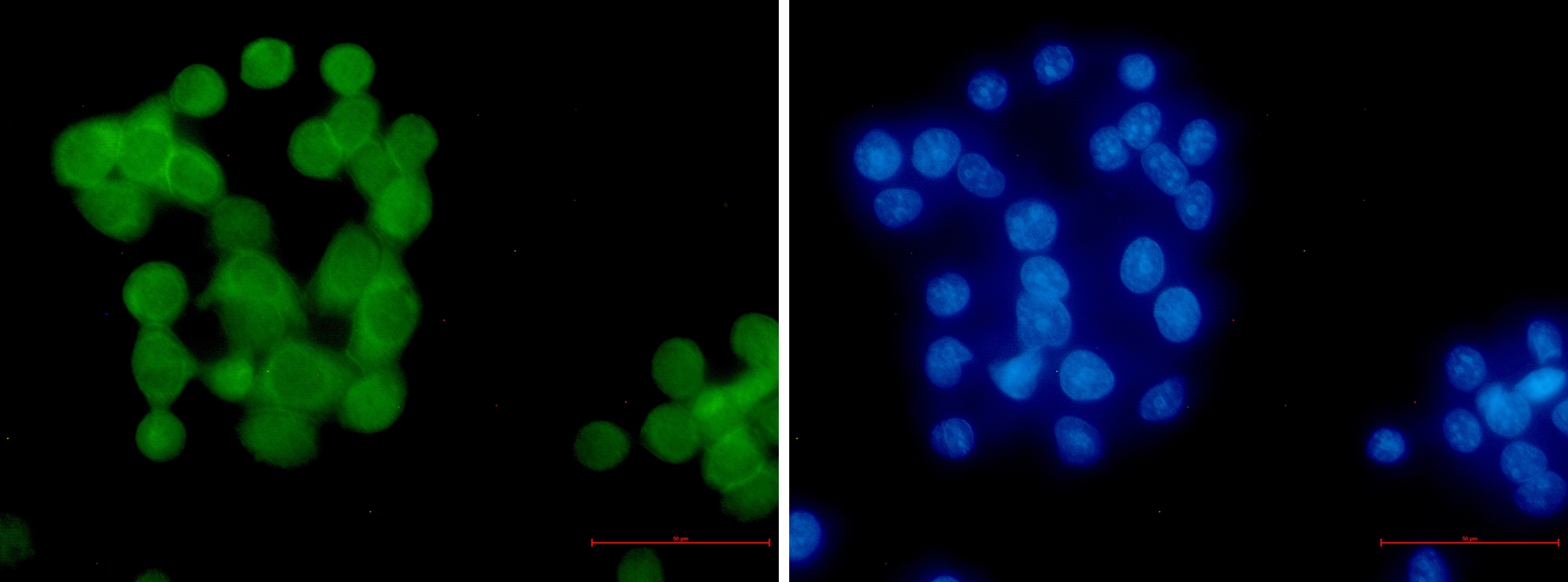 Ubiquitin K63 Rabbit mAb