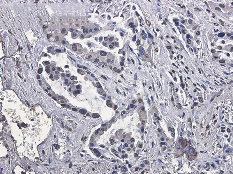 VPS35 Rabbit mAb