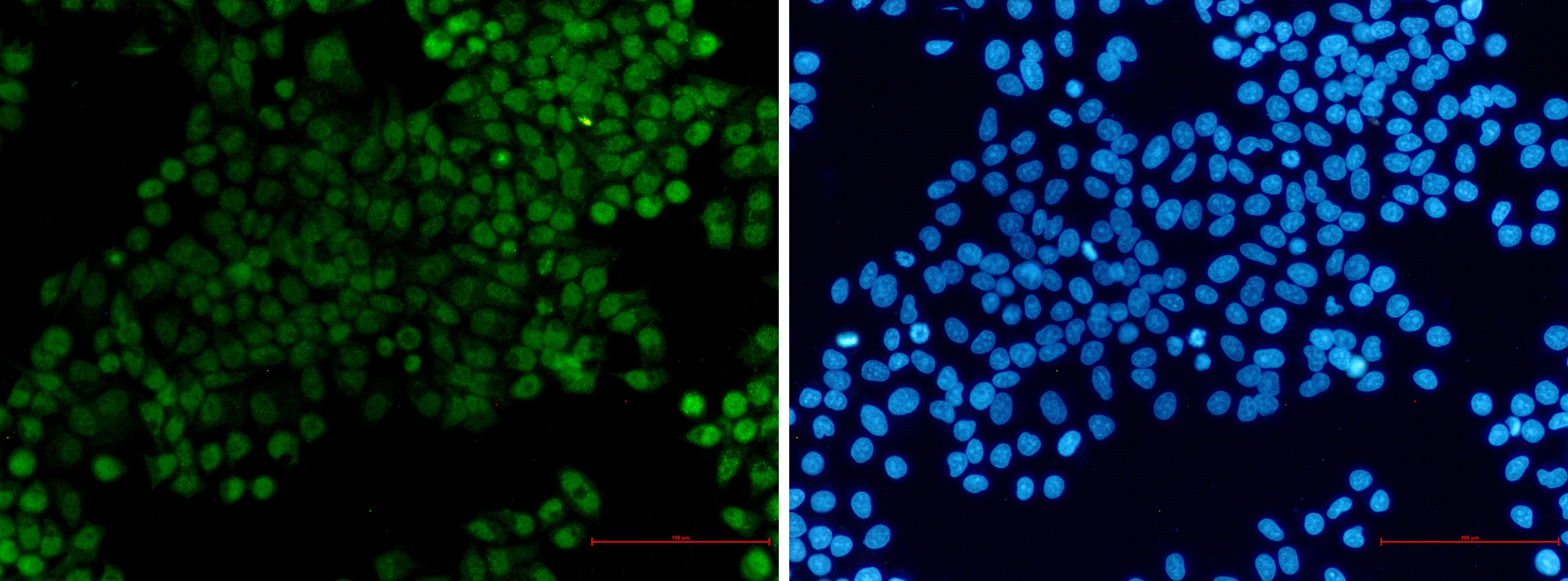 XRCC1 Rabbit mAb