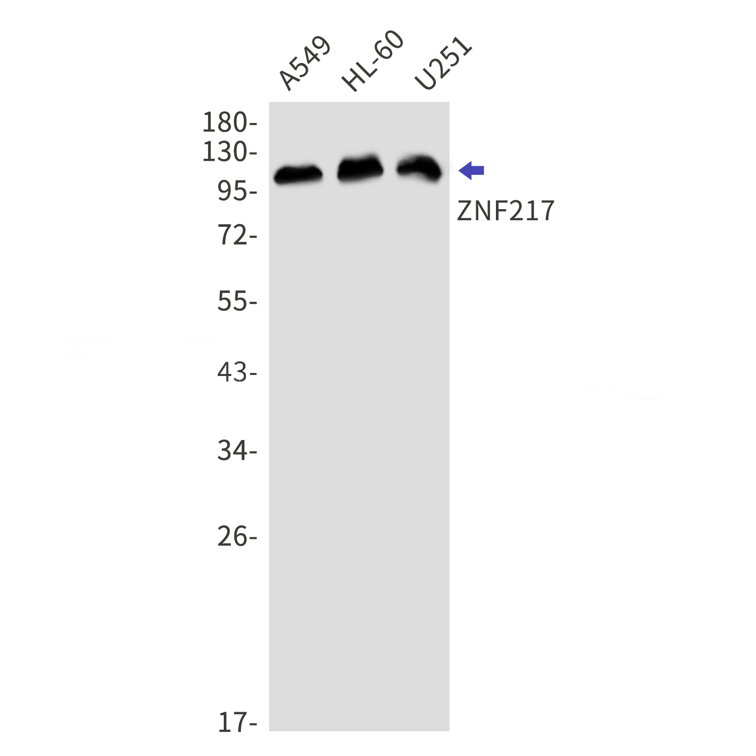 ZNF217 Rabbit mAb