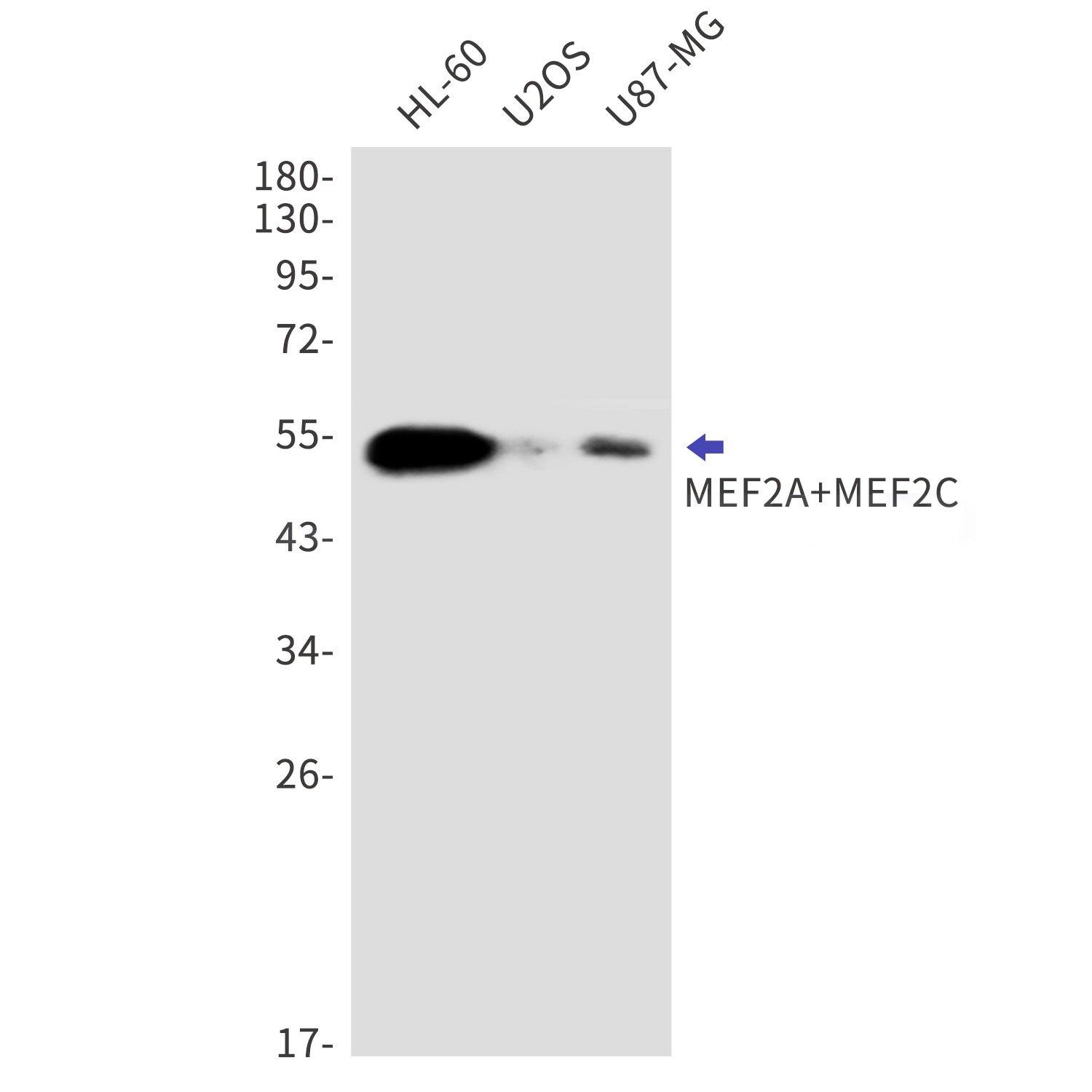 MEF2A/MEF2C Rabbit mAb