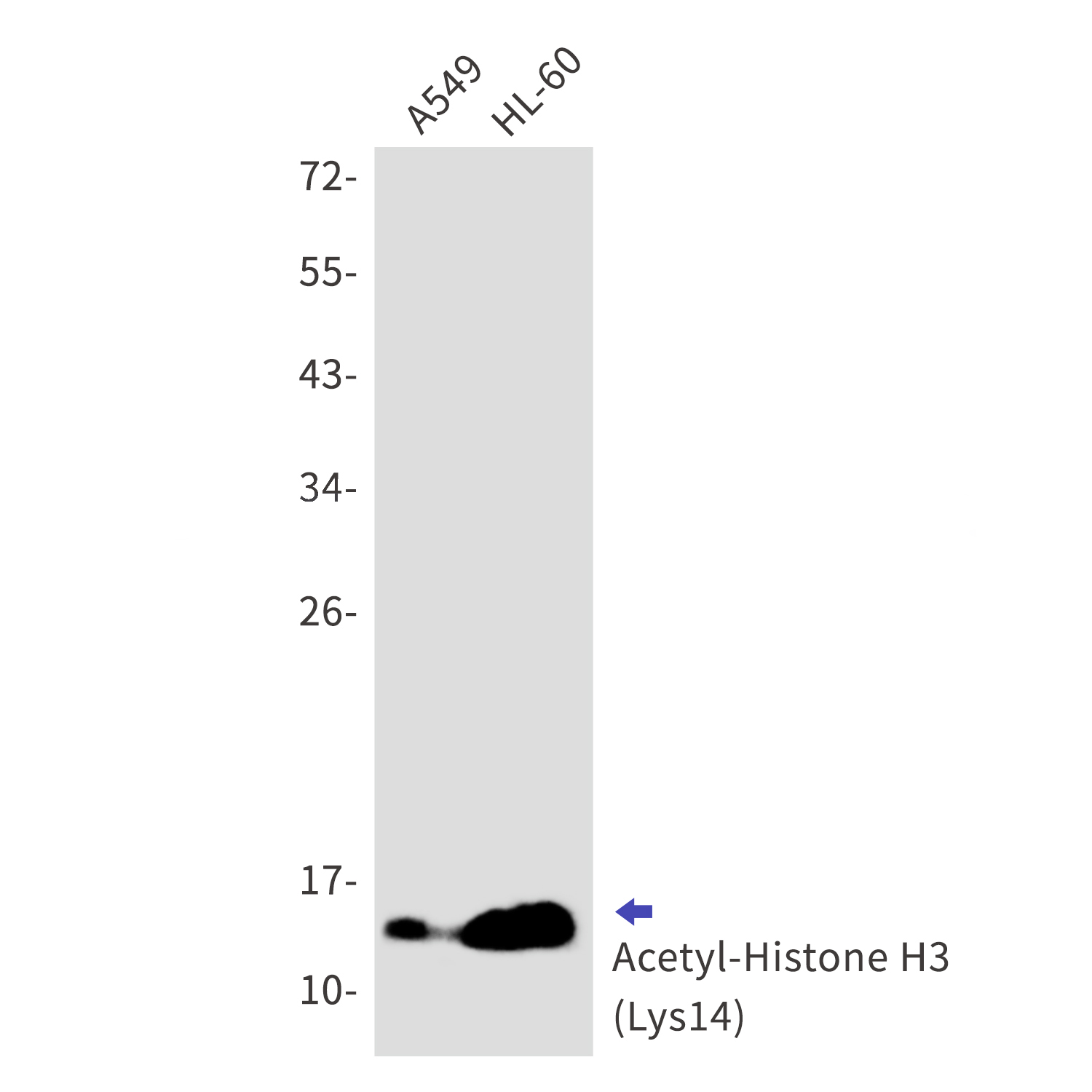 Acetyl-Histone H3 (Lys14) Rabbit mAb