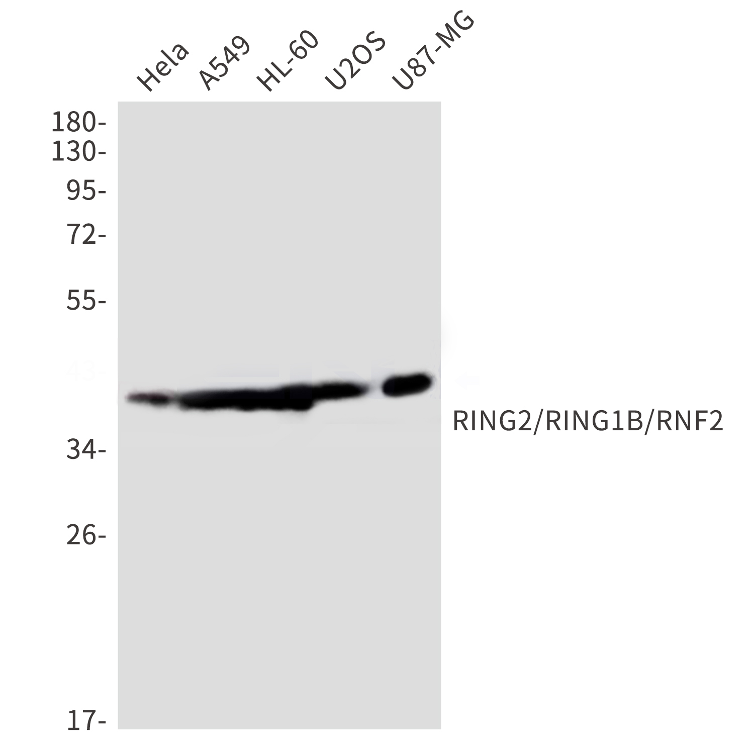 RING2 Rabbit mAb