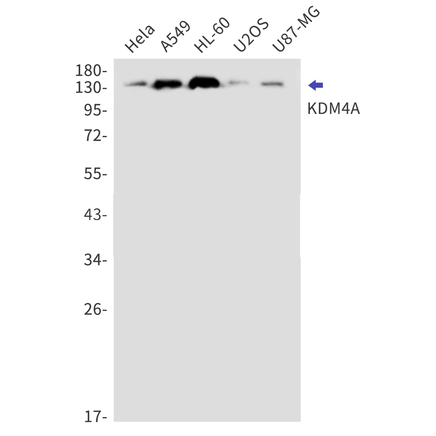 KDM4A Rabbit mAb