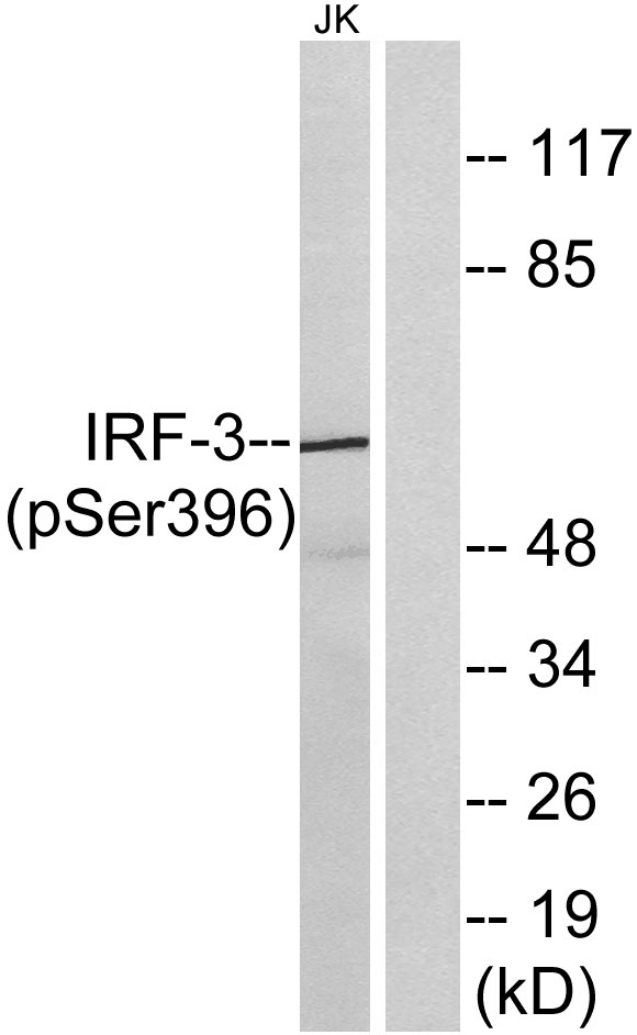 IRF-3 (phospho Ser396) Polyclonal Antibody