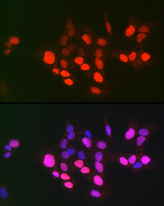 TOP2A Rabbit Polyclonal Antibody