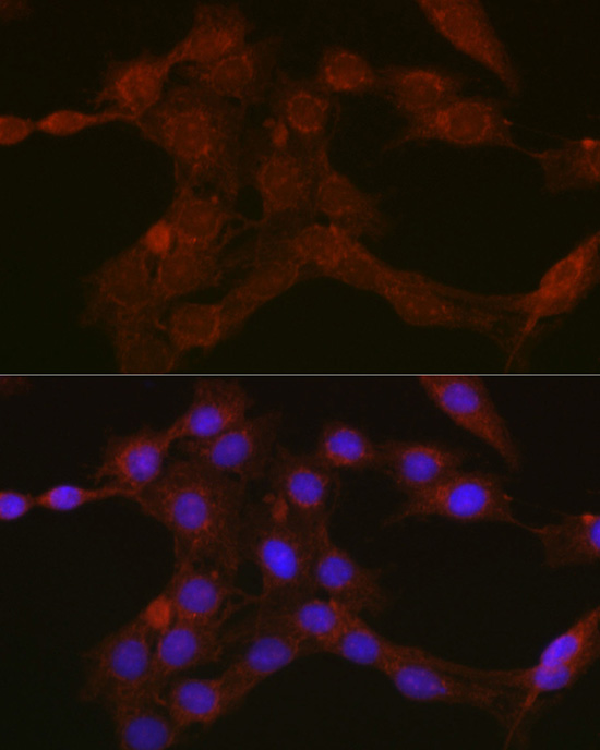 Gasdermin-D (Full Length+N terminal) Rabbit Polyclonal Antibody