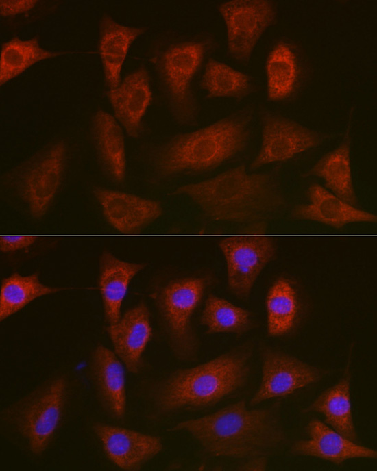 Gasdermin-D (Full Length+N terminal) Rabbit Polyclonal Antibody