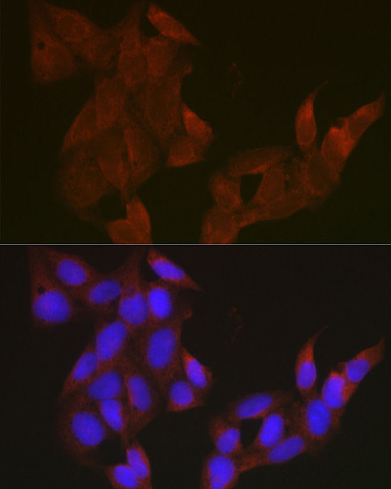 Gasdermin-D (Full Length+N terminal) Rabbit Polyclonal Antibody