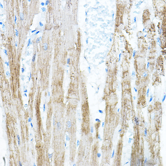 PDK4 Rabbit Polyclonal Antibody