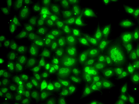 TBL1XR1 Rabbit Polyclonal Antibody