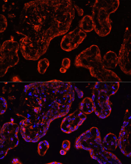 COL20A1 Rabbit Polyclonal Antibody