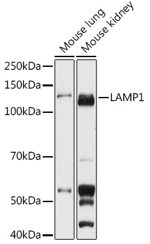 LAMP1 Rabbit Polyclonal Antibody