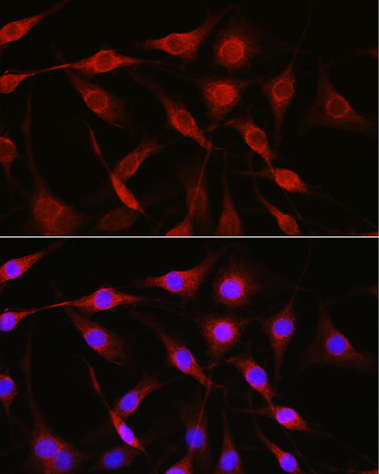 LAMP1 Rabbit Polyclonal Antibody