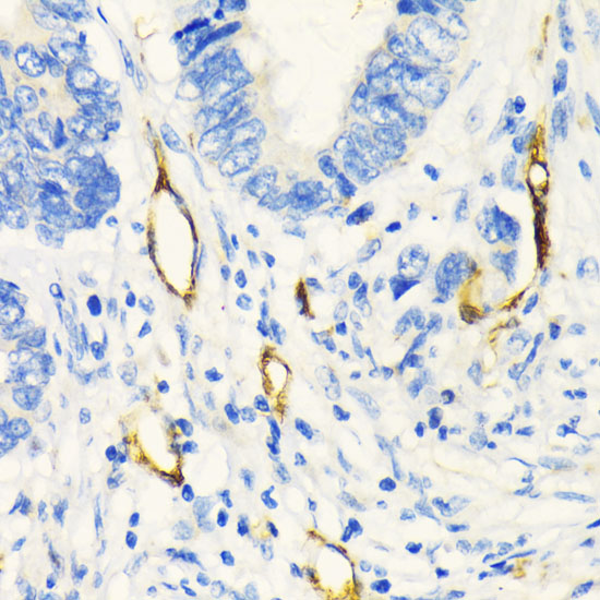 MCAM Rabbit Polyclonal Antibody