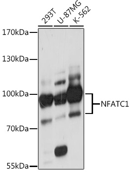NFATC1 Rabbit Polyclonal Antibody