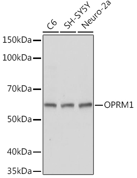 OPRM1 Rabbit Polyclonal Antibody