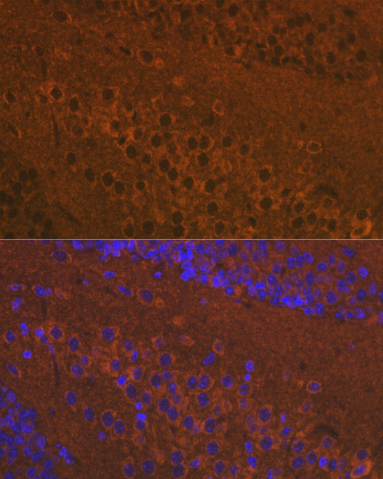 OPRM1 Rabbit Polyclonal Antibody