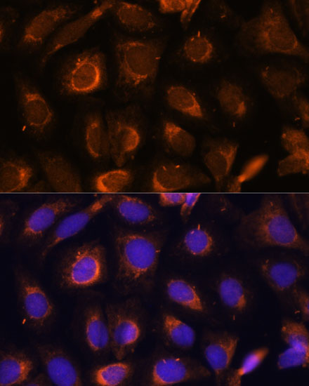 SHMT1 Rabbit Polyclonal Antibody