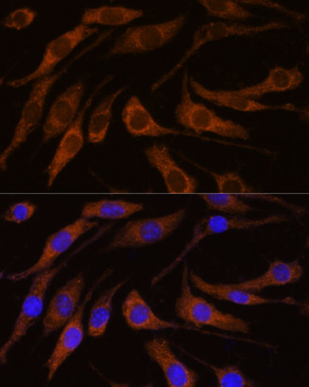 BRPF1 Rabbit Polyclonal Antibody