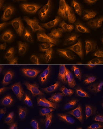 GRID2 Rabbit Polyclonal Antibody
