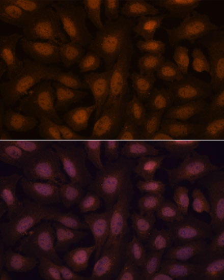 POU4F2 Rabbit Polyclonal Antibody